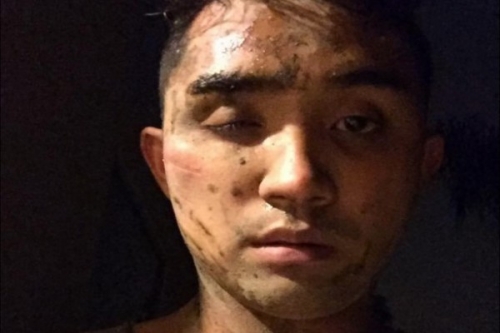 На гея напали приказав молчать или порежут горло